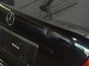 Normal dent-before